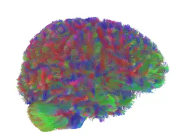 Una imagen representativa de tractografía por resonancia magnética de la primera era del cerebro humano. Esta imagen es representativa del patrón general observado en los cerebros del estudio durante la primera era del cableado neuronal, entre los cero y los nueve años. Una imagen representativa de tractografía por resonancia magnética de la primera era del cerebro humano. Esta imagen es representativa del patrón general observado en los cerebros del estudio durante la primera era del cableado neuronal, entre los cero y los nueve años.
