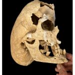 El cráneo corresponde a un individuo de entre 45 y 49 años. El cráneo corresponde a un individuo de entre 45 y 49 años.