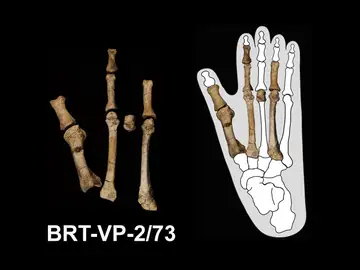 El pie de Burtele (izquierda) y el pie superpuesto sobre el contorno de un pie de gorila El pie de Burtele (izquierda) y el pie superpuesto sobre el contorno de un pie de gorila