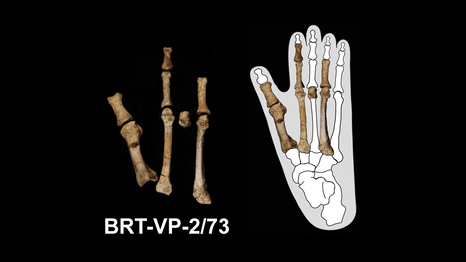 El pie de Burtele (izquierda) y el pie superpuesto sobre el contorno de un pie de gorila