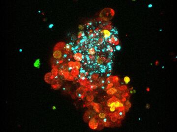 Modelo de tumor de cáncer de mama hormonodependiente