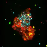 Modelo de tumor de cáncer de mama hormonodependiente