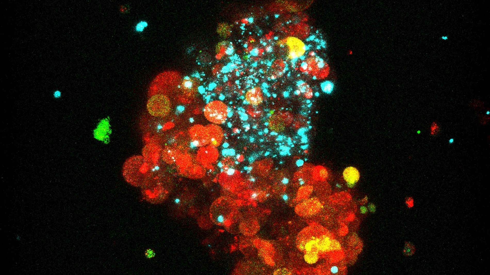 Modelo de tumor de cáncer de mama hormonodependiente
