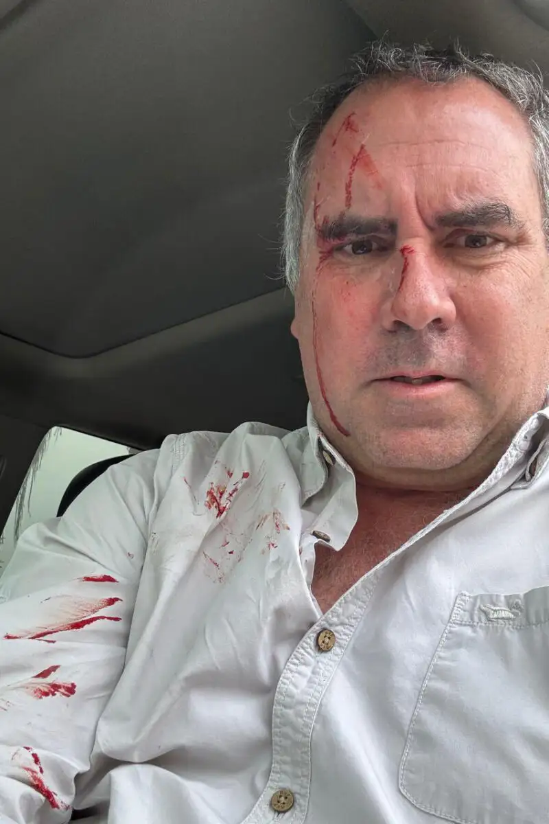 Candidato presidencial de Perú sale ileso de atentado al ser atacado a tiros en vehículo