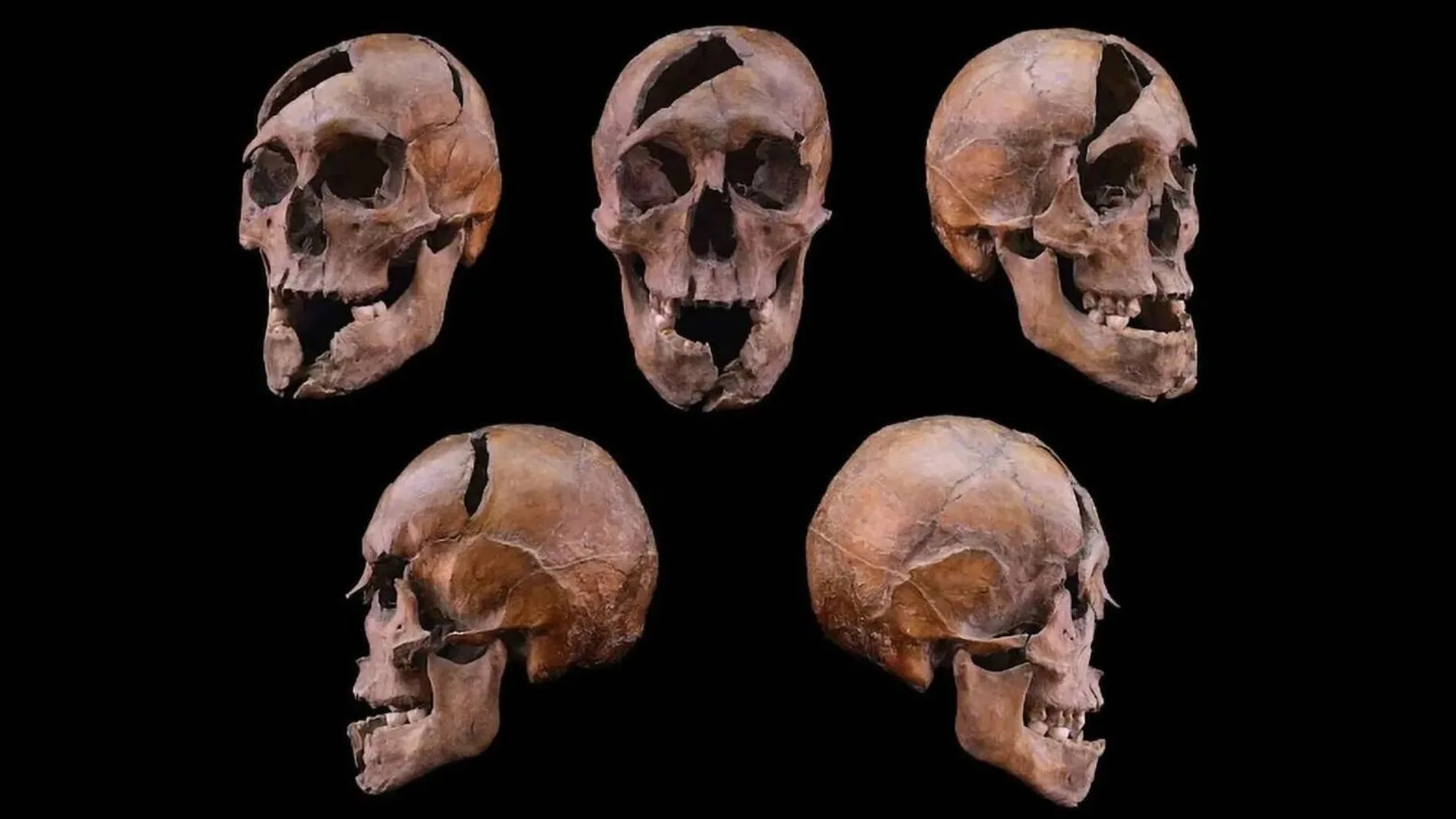 El cráneo del duque de Macsó