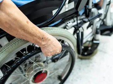 Los tratamientos modificadores de la enfermedad han cambiado el pronóstico, especialmente si se inician de forma temprana Los tratamientos modificadores de la enfermedad han cambiado el pronóstico, especialmente si se inician de forma temprana