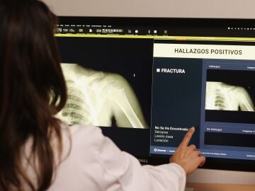 Una radi&oacute;loga de Cl&iacute;nica CEMTRO emplea IA para detectar fracturas 