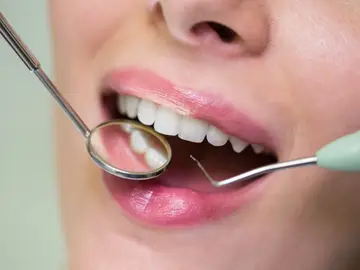 Chica en el dentista Chica en el dentista