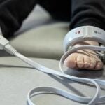 Paciente con una enfermedad rara recibe atenci&oacute;n m&eacute;dica en una imagen de archivo