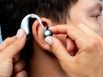 Profesional coloca un audífono a un paciente Estimulación auditiva en un experimento científico sobre el cerebro y la enfermedad de Alzheimer