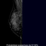 Lectura de las mamograf&iacute;as por parte del programa AI WaveMar 