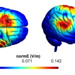 En tonos c&aacute;lidos las zonas estimuladas en el cerebro