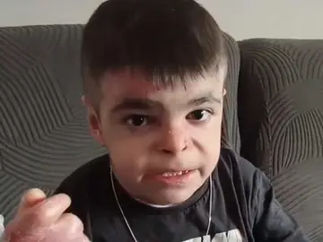 Leo, el niño de 12 años con piel de mariposa: "Lo más doloroso es que un niño normal no siente dolor todos los días, personas como nosotros lamentablemente sí" Leo, el niño de 12 años con piel de mariposa: "Lo más doloroso es que un niño normal no siente dolor todos los días, personas como nosotros lamentablemente sí"