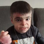 Leo, el ni&ntilde;o de 12 a&ntilde;os con piel de mariposa: "Lo m&aacute;s doloroso es que un ni&ntilde;o normal no siente dolor todos los d&iacute;as, personas como nosotros lamentablemente s&iacute;" 