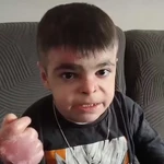 Leo, el niño de 12 años con piel de mariposa: "Lo más doloroso es que un niño normal no siente dolor todos los días, personas como nosotros lamentablemente sí"