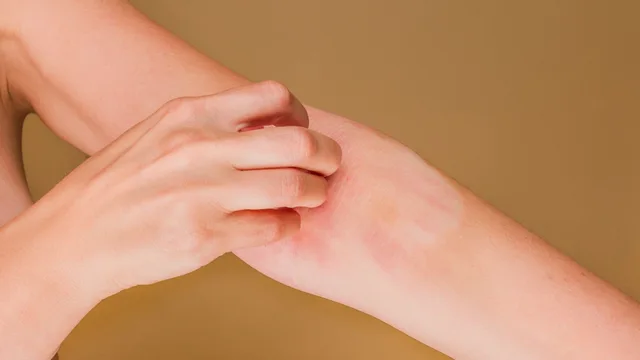 Adiós al picor de piel: investigadores descubren como dejar de rascarse