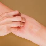 Adi&oacute;s al picor de piel: investigadores descubren como dejar de rascarse