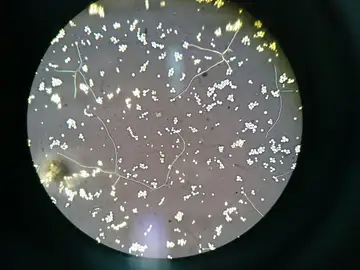 Detalle del hongo Cryptococcus neoformans Microbiología