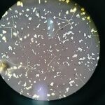 Detalle del hongo Cryptococcus neoformans