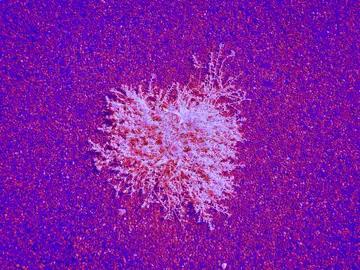 La biología de las células abre una puerta a nuevos tratamientos oncológicos La biología de las células abre una puerta a nuevos tratamientos oncológicos