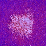 La biolog&iacute;a de las c&eacute;lulas abre una puerta a nuevos tratamientos oncol&oacute;gicos