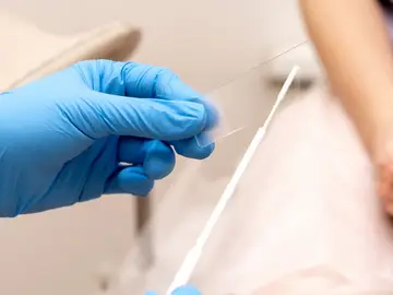 Tratar también al homnbre reduce la recurrencia de esta infección en un 60% Tratar también al homnbre reduce la recurrencia de esta infección en un 60%