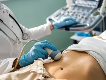 El carcinoma hepatocelular es un tumor especialmente agresivo y difícil de tratar. / iStock. El carcinoma hepatocelular es un tumor especialmente agresivo y difícil de tratar. / iStock.