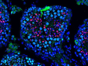 Transducci&oacute;n de ARNm EGFP en t&uacute;bulos semin&iacute;feros, mostrando una fuerte fluorescencia verde en c&eacute;lulas de Sertoli. Rojo: c&eacute;lulas haploides. Cian: c&eacute;lulas mei&oacute;ticas SYCP3+.