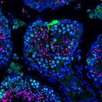Transducci&oacute;n de ARNm EGFP en t&uacute;bulos semin&iacute;feros, mostrando una fuerte fluorescencia verde en c&eacute;lulas de Sertoli. Rojo: c&eacute;lulas haploides. Cian: c&eacute;lulas mei&oacute;ticas SYCP3+.