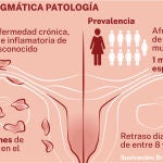 Prevalencia endometriosis 
