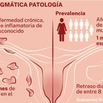 Prevalencia endometriosis