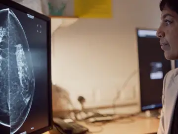 Una radióloga observa los resultados en una pantalla Una radióloga observa los resultados en una pantalla