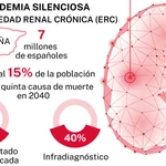Enfermedad renal crónica (ERC)