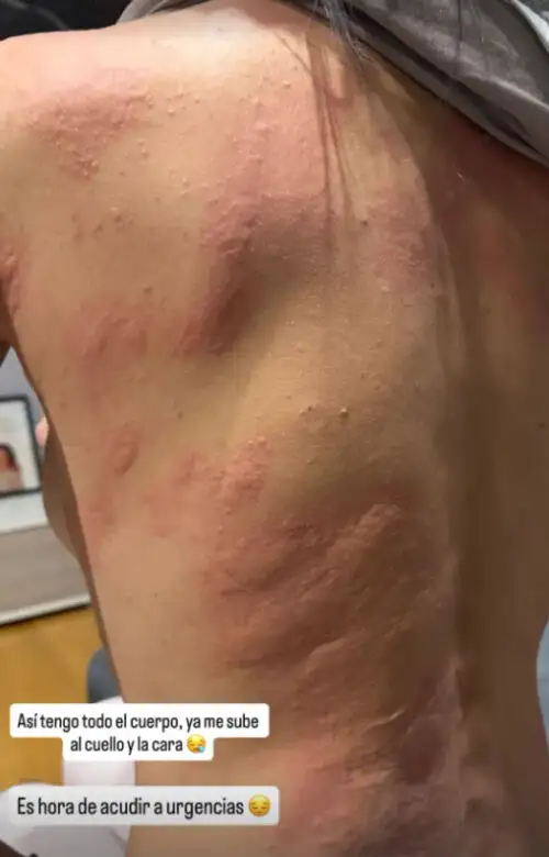 Story de Fani Carbajo