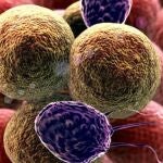 Met&aacute;stasis - Destacada