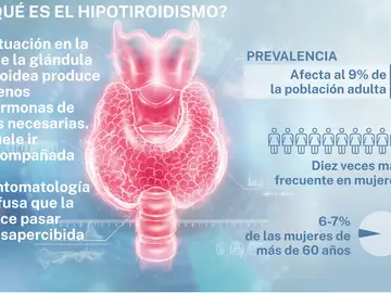 Hipotiroidismo Hipotiroidismo
