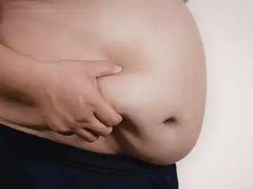 Imagen de archivo de una persona con sobrepeso Imagen de archivo de una persona con sobrepeso