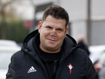 Lucas encara su esperada cirug&iacute;a de nariz tras meses de complicaciones: "M&aacute;s vale tener paciencia"