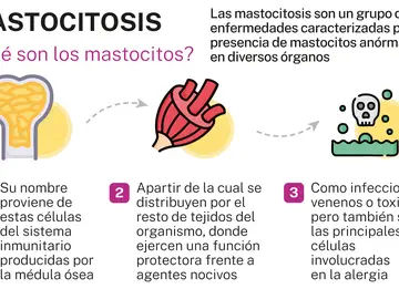 Mastocitosis Mastocitosis