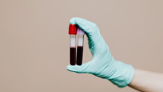 Imagen de archivo de unos an&aacute;lisis de sangre