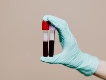 Imagen de archivo de unos an&aacute;lisis de sangre