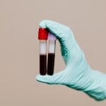 Imagen de archivo de unos an&aacute;lisis de sangre