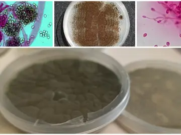 La comunidad internacional de micología científica y médica propone un plan global contra las resistencias antifúngicas La comunidad internacional de micología científica y médica propone un plan global contra las resistencias antifúngicas