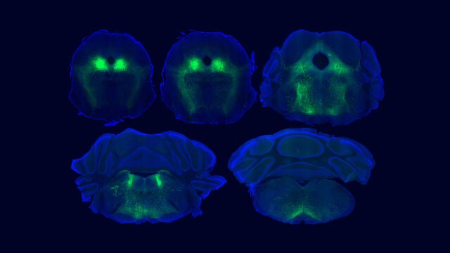 Im&aacute;genes fluorescentes de un circuito cerebral implicado en el efecto placebo en ratones.