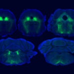 Im&aacute;genes fluorescentes de un circuito cerebral implicado en el efecto placebo en ratones.