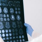 Estas son las bebidas que est&aacute;n consideradas como "oro para el cerebro": una reduce el riesgo de demencia