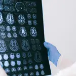 Estas son las bebidas que están consideradas como "oro para el cerebro": una reduce el riesgo de demencia