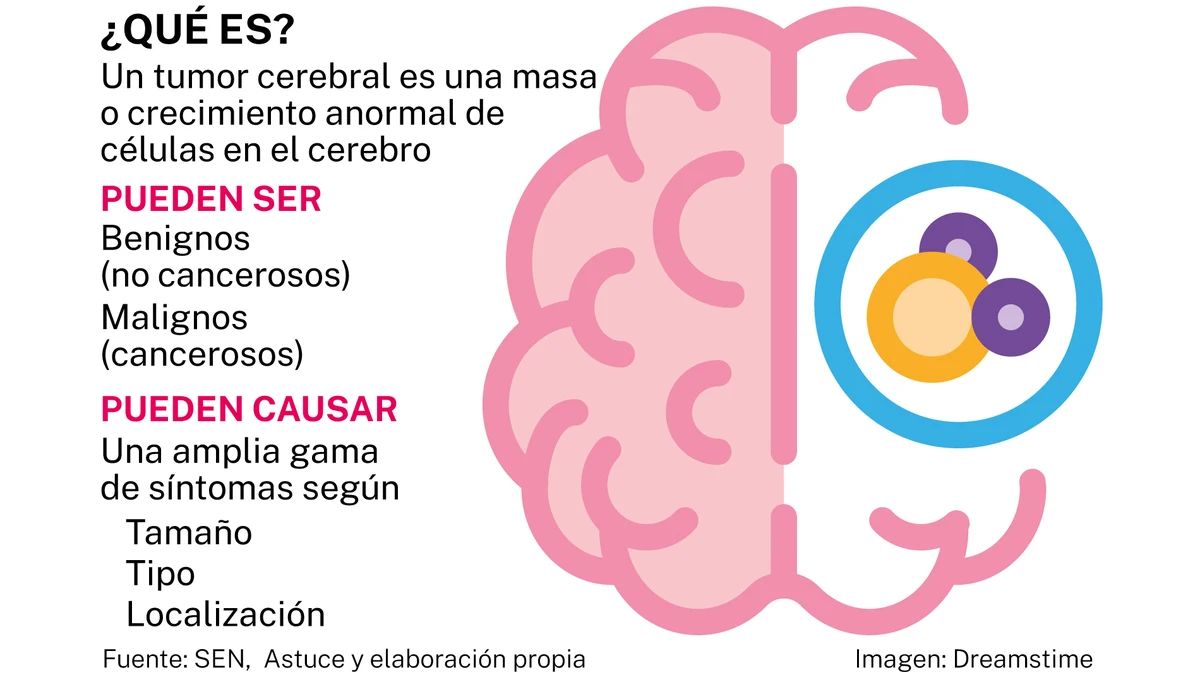 Tumor cerebral