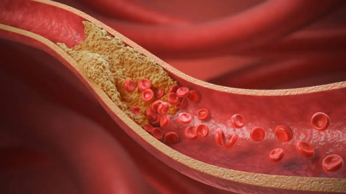 Un estudio descubre una nueva diana para combatir el colesterol LDL
