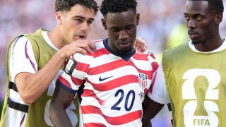 Mundial de la FIFA 2026: Estados Unidos - Bosnia Herzegovina GR4032. SANTA CLARA (ESTADOS UNIDOS), 01/07/2026.- Folarin Balogun (c) de Estados Unidos reacciona al ser expulsado este miércoles, en un partido de los dieciseisavos de final del Mundial de la FIFA 2026 entre Estados Unidos y Bosnia Herzegovina en el estadio Levi's en Santa Clara (Estados Unidos). EFE/ Omar Alonso
